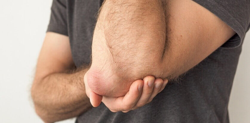 Gout affects several joints in the body