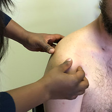 Upper Limb Orthopeadic Treatment