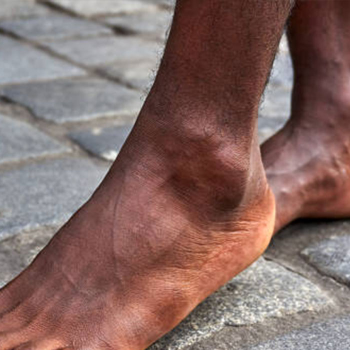Ankle